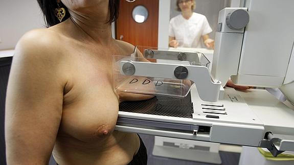 Una mujer se realiza una mamografía 