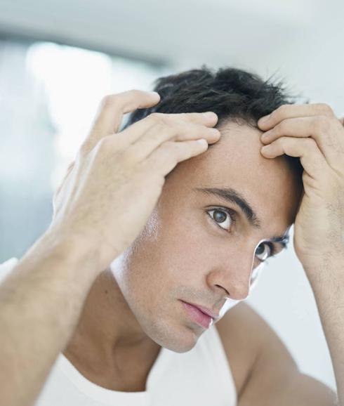 El problema más habitual es la alopecia androgenética.