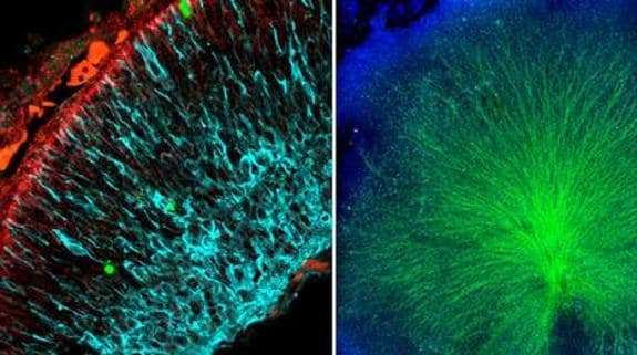 A la izquierda, sección de un ojo de ratón durante el desarrollo embrionario donde se ven las neuronas (azul) y las mitocondrias (rojo). A la derecha, los axones de esas neuronas. 