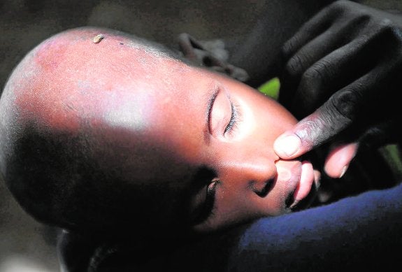 Un niño, en un campamento de atención médica de Mogadiscio, en Somalia, en una imagen de archivo.
