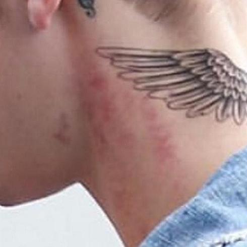 Tatuaje y marcas en el cuello de Justin Bieber.