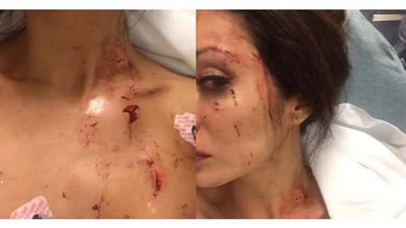 Victoria del Rosal tras el incidente, en una foto difundida por ella misma en sus redes sociales