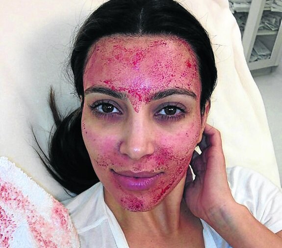 Kim Kardashian. La 'celebrity' alterna trucos caseros con las últimas tendencias en belleza, como inyectarse su sangre en la cara. 