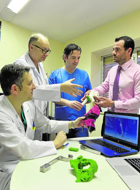 Pablo Puertas, Juan Ángel Fernández, Antonio Valcárcel y Conrado Baño, en una sesión clínica con las reproducciones 3D de los tumores y la pelvis de dos pacientes.
