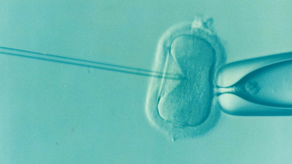 Un matrimonio descubre que son mellizos en unas pruebas de fertilidad