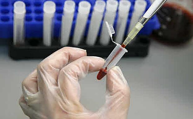 Un técnico de laboratorio examina muestras de sangre para descartar la presencia del virus VIH.