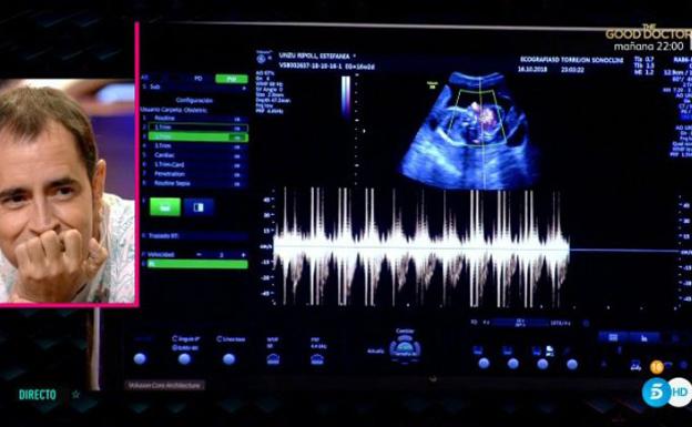 Aritz, observa emocionado la ecografía. 