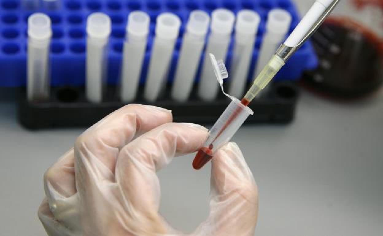 Prueba serológica para la detección del VIH.