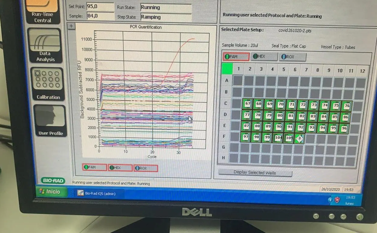 Imagen de pruebas diagnósticas PCR. En rojo y con una curva sobresaliente un caso con enorme carga viral.
