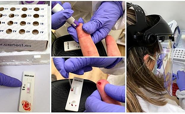 Los test rápidos de anticuerpos, camino de las farmacias bajo prescripción