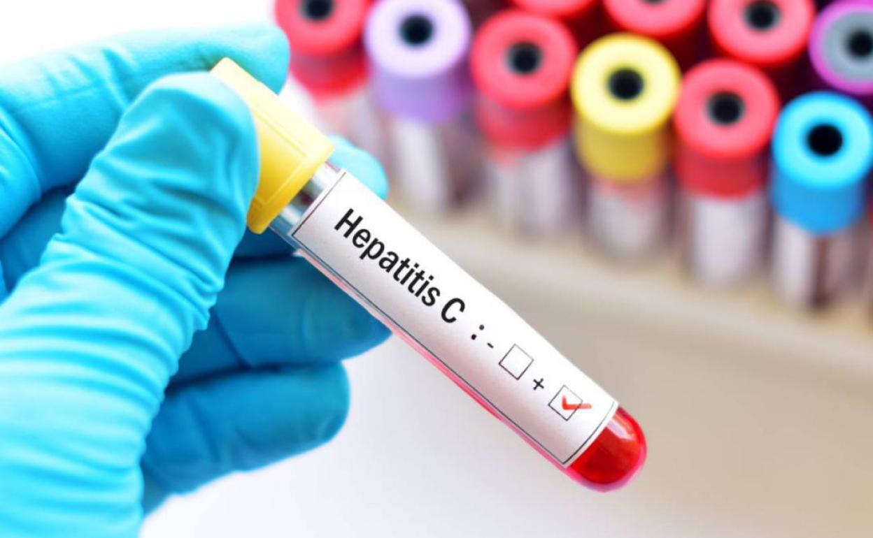 España estaba en condiciones de eliminar la infección por Hepatitis C para el 2023. 