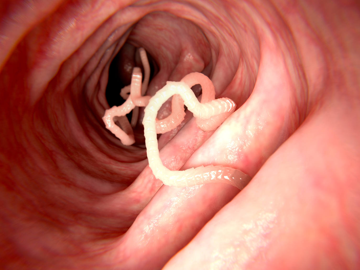 11. La mayoría de los fallecimientos por causa de la tenia se dan en las zonas rurales de los países en desarrollo, porque la infección está relacionada con la falta de higiene. Estos 'feos' bichos transmiten la enfermedad a través de las heces humanas.