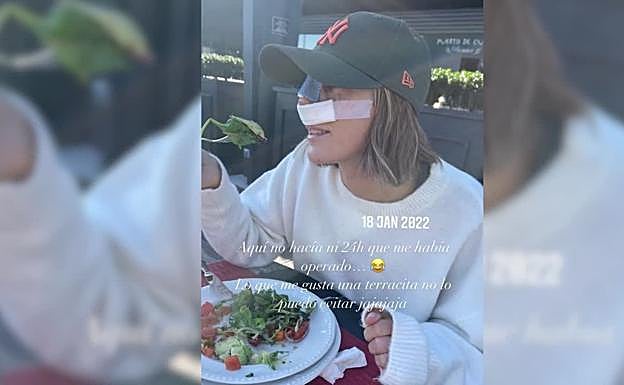 Anna Ferrer Padilla se somete a una rinoplastia.