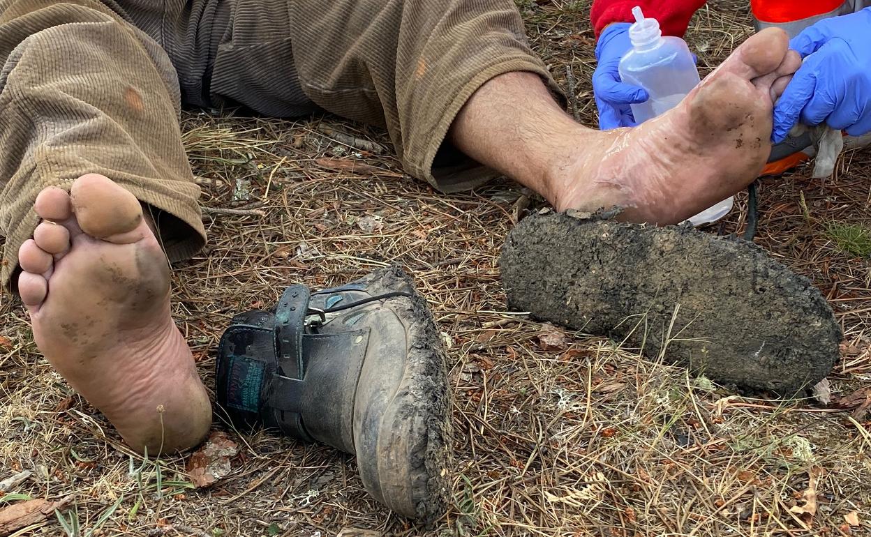 Un hombre recibe una cura tras acceder a zonas con brasas para tratar de sofocar las llamas del incendiode Zamora.