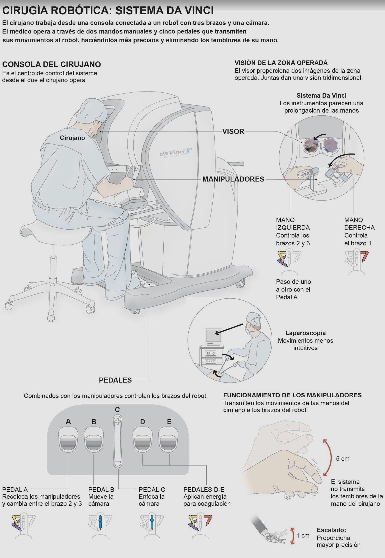 Funcionamiento de los mandos del robot Da Vinci.