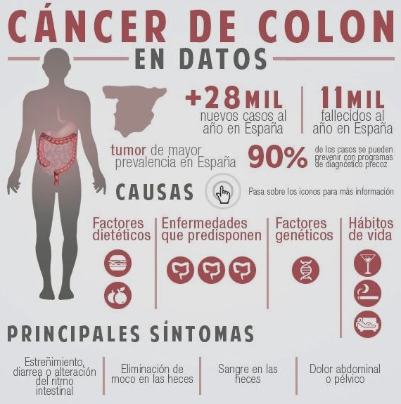 Datos nacionales del cáncer de colon, uno de los más dañinos.