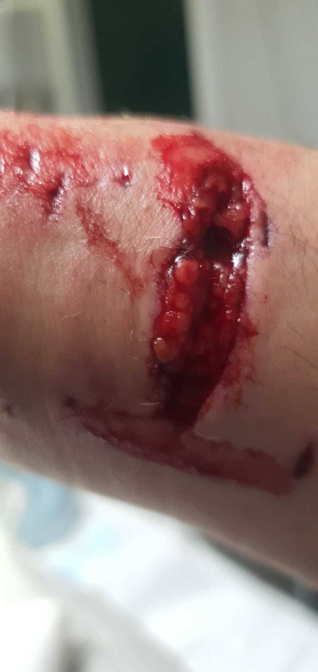 Dos pitbull atacan a un hombre en Villaobispo