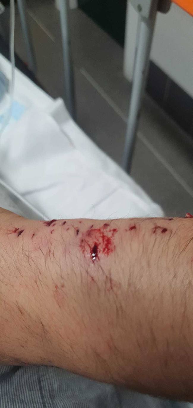 Dos pitbull atacan a un hombre en Villaobispo