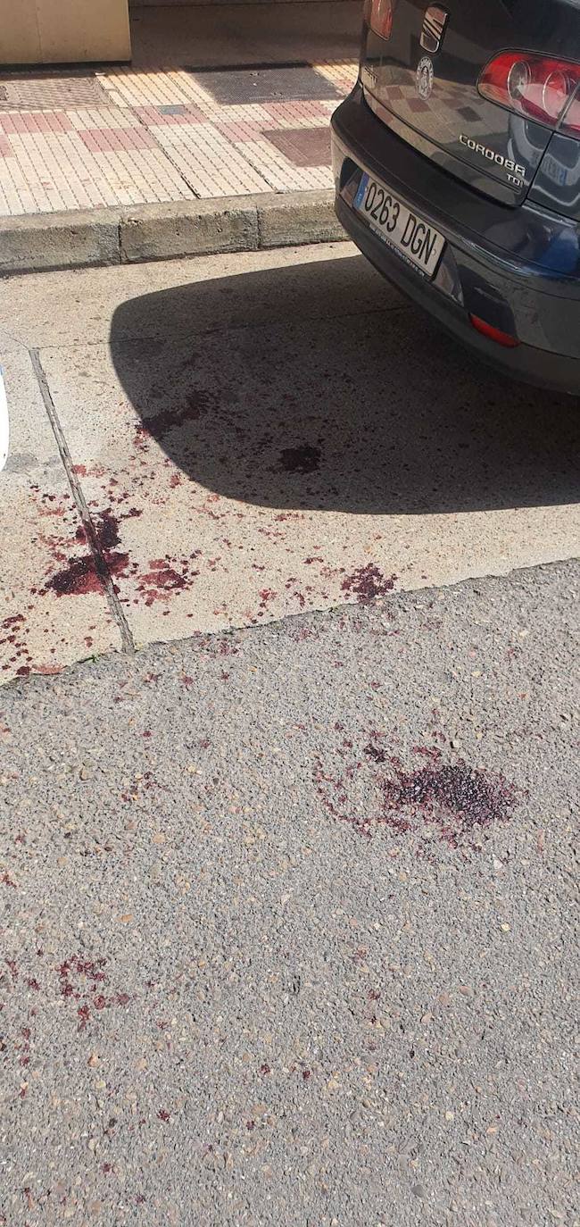 Dos pitbull atacan a un hombre en Villaobispo