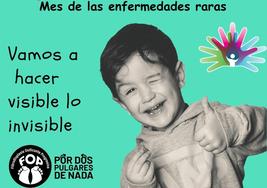 'Por dos pulgares de nada' tratará de «hacer visible lo invisible» durante el mes de las enfermedades raras