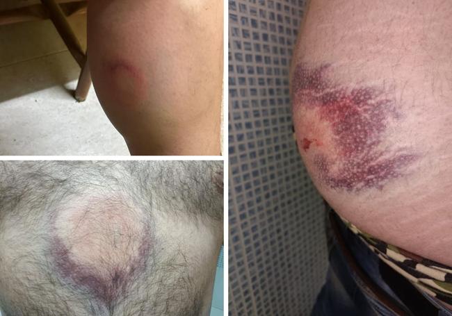 Heridas de varios de los agricultores leoneses implicados.