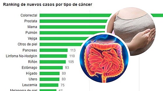 El cáncer colorrectal, el primero en número de casos y el segundo más mortal en León