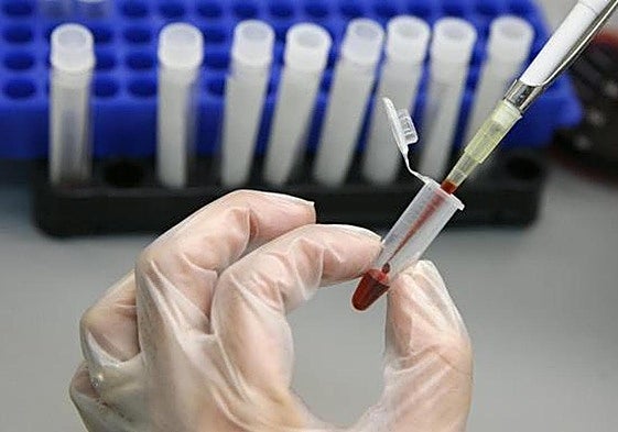 Prueba para detectar la enfermedad.