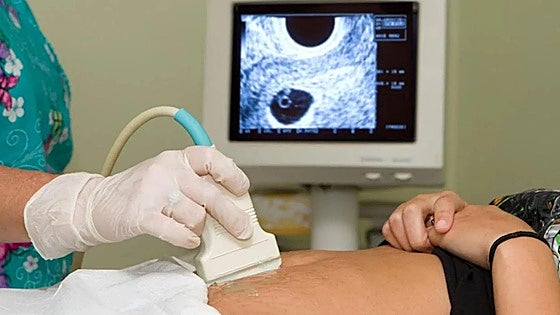 Castilla y León trabaja ya en su registro de objetores de conciencia ante el aborto