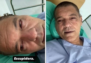 El leonés Frank Cuesta, hospitalizado de urgencia tras la mordedura de una cobra escupidora