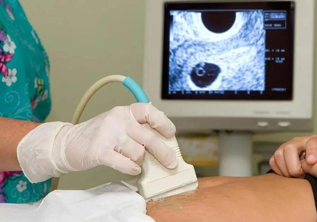 Más de 600 mujeres decidieron abortar en León en 2024