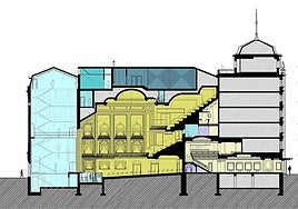 Imagen de un plano de la intervención funcional.