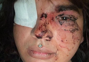 Una mujer trans denuncia una brutal agresión por ocho personas en La Bañeza