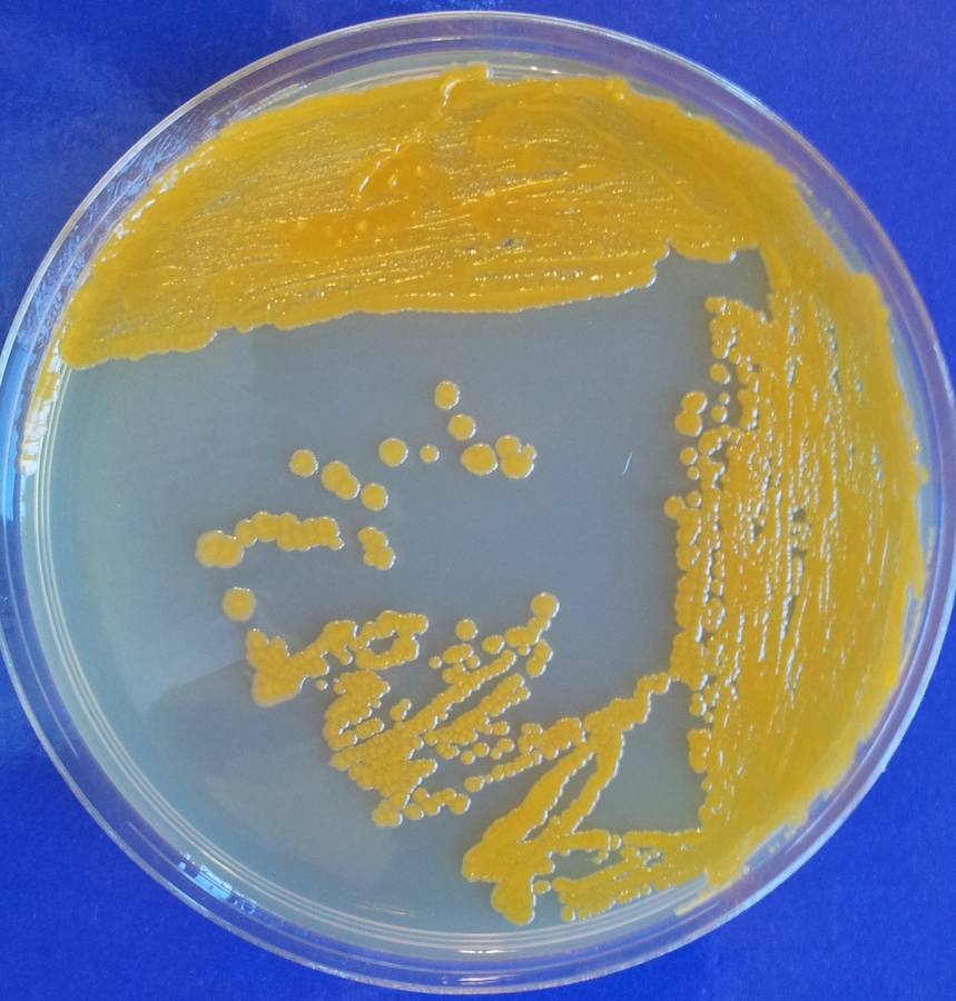 Colonias de la bacteria Mycobacterium neoaurum NRRL B-3805, con su color dorado, de ahí el 'neoaurum' del nombre