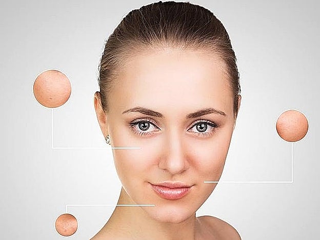 Galería. Granitos, rojeces, descamaciones, irritaciones, aspereza al taco... son los síntomas de la piel sensible.