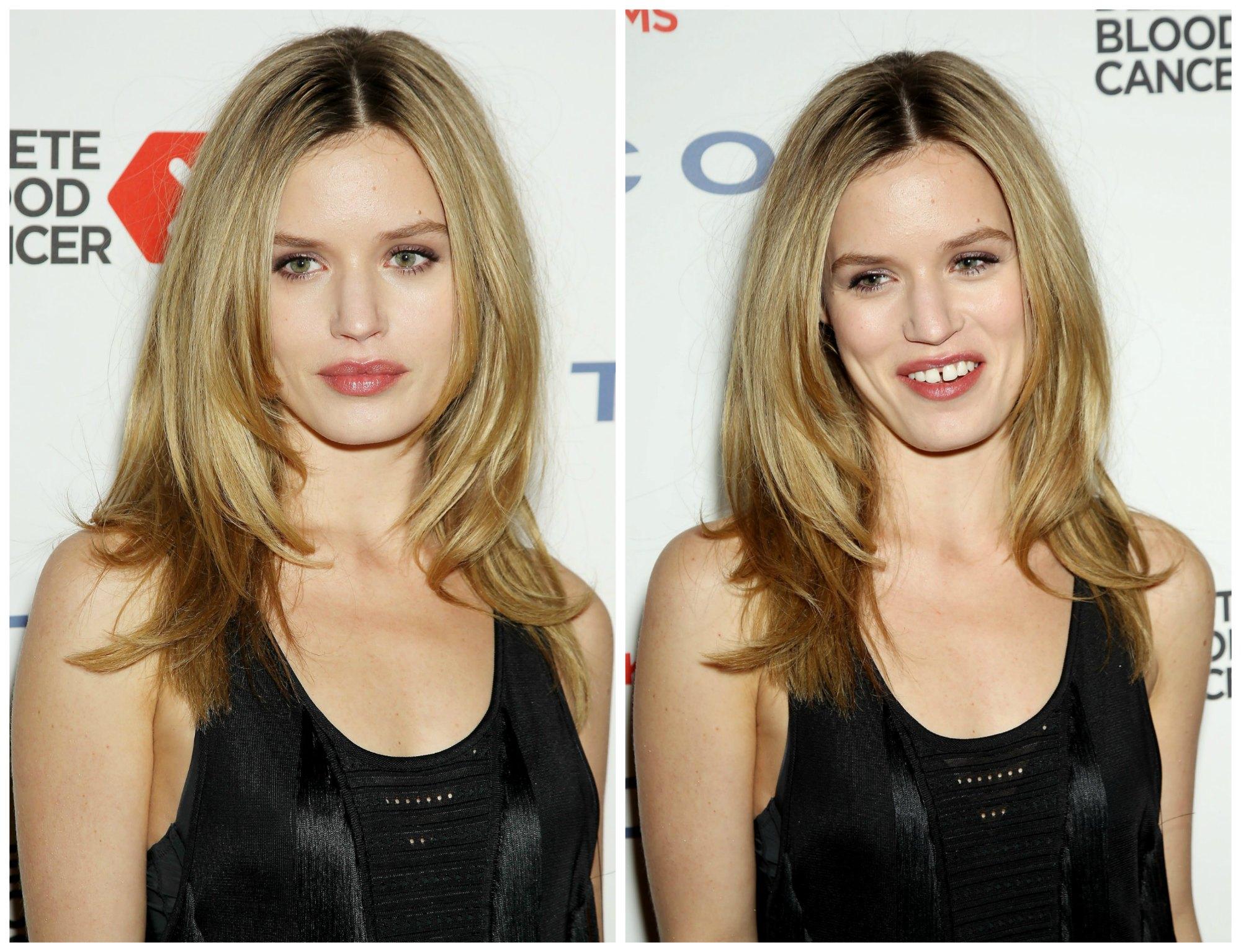 Con la modelo nos pasa lo mismo que con Vanessa Paradis: aunque la sepación de sus dientes es una de sus señas de identidad, nos gusta más presumiendo de 'boquita de piñón'.