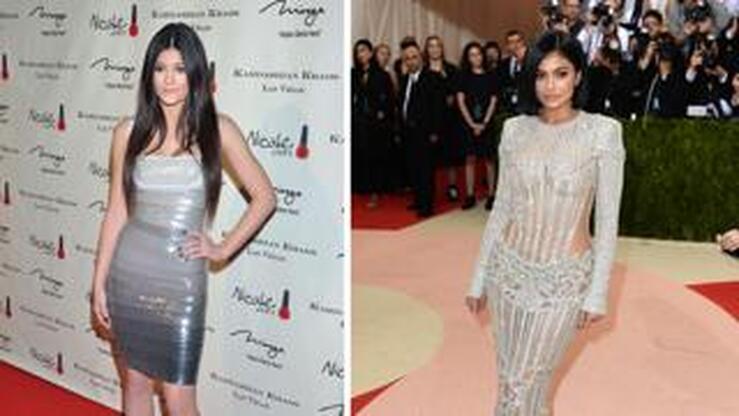 Fotos: El antes y el después de Kylie Jenner