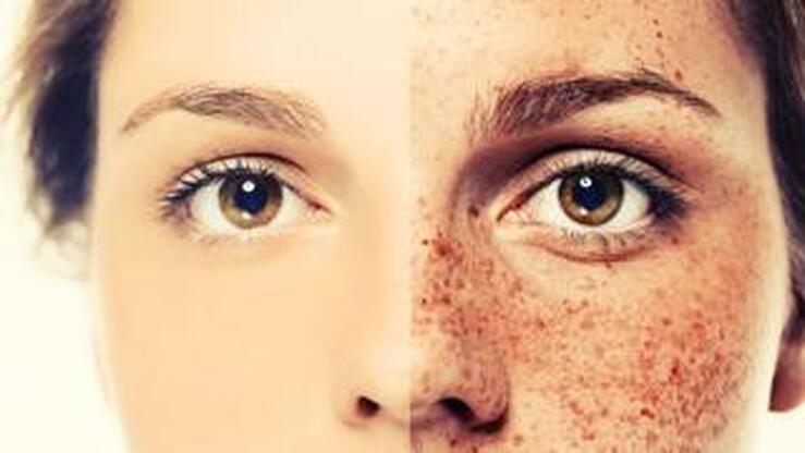 Fotos: 15 cosméticos para acabar con las manchas de la piel