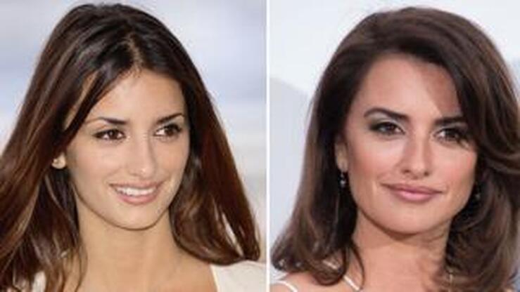 Fotos: Famosas que se han operado la nariz: conoce el antes y el después