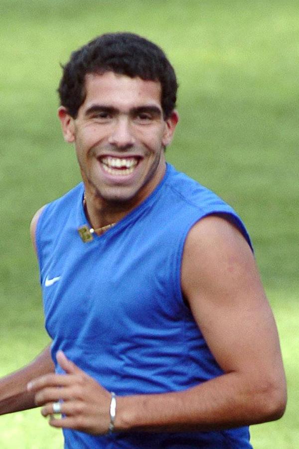 El futbolista argentino Carlos Tévez siempre ha presumido de sus orígenes humildes y de la marca que tiene en su cuello, que se hizo al quemarse de pequeño con agua hirviendo... Sin embargo, sus dientes ya son otra cosa...