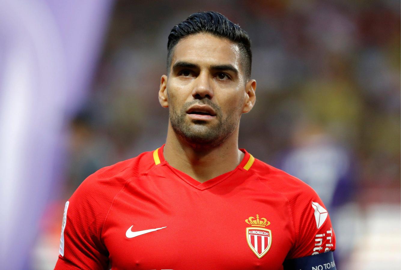 Falcao se operó de su tabique nasal durante su estancia en el Atlético de Madrid. Así de uniforme luce su nariz en la actualidad.