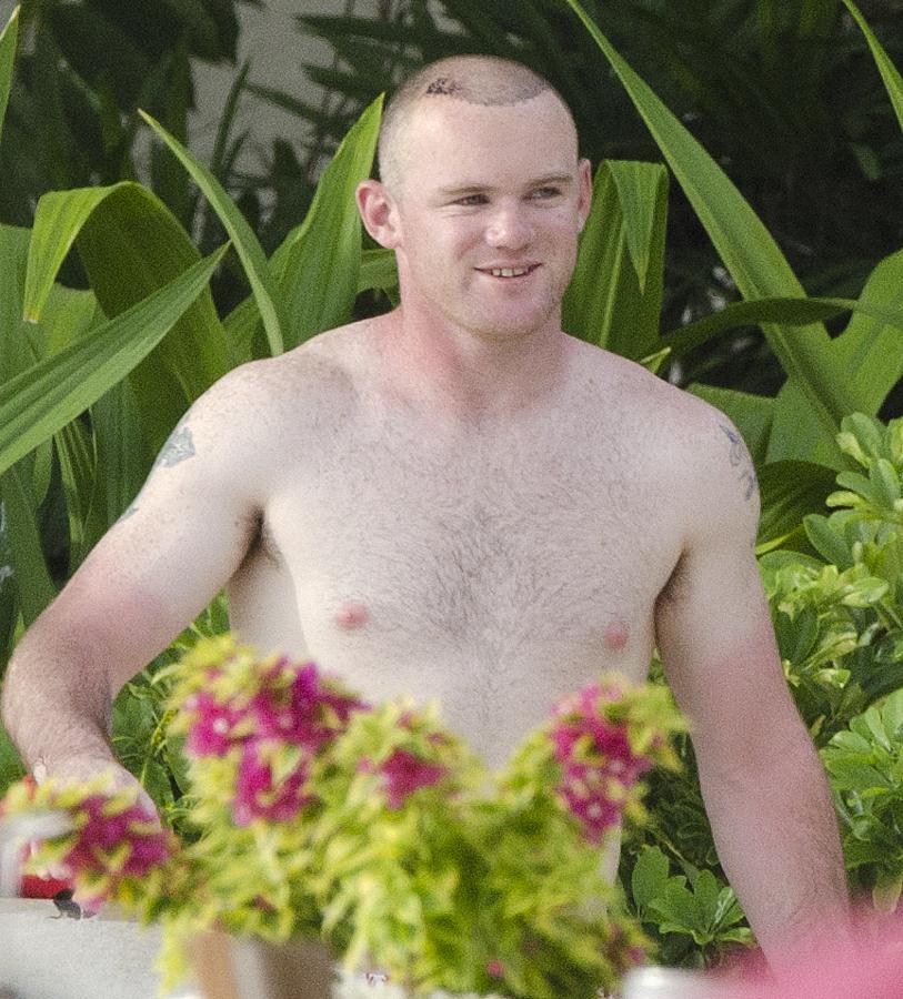 En 2011 Rooney dijo "basta" y se sometió a un injerto capilar. El jugador nunca lo ocultó y aquí le vemos, recién injertado, durante unas vacaciones en Barbados en 2011.