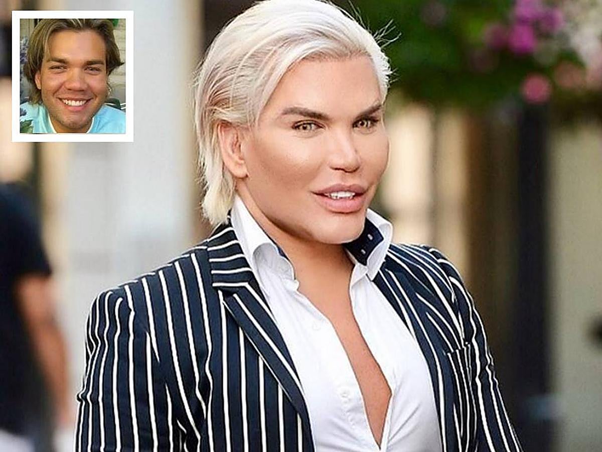 Así era y así es. Después de 59 intervenciones –la última de ellas un trasplante de pelo para disminuir el tamaño de su frente- ha conseguido perder toda humanidad en su rostro.