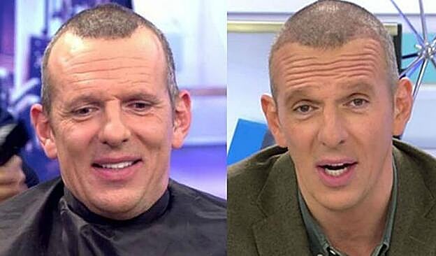 Joaquín Prat antes y después del retoque capilar.