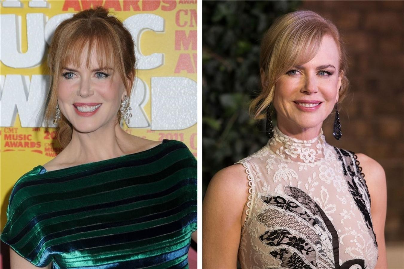 Nicole Kidman es una de las actrices más aficionadas a los retoques estéticos.
