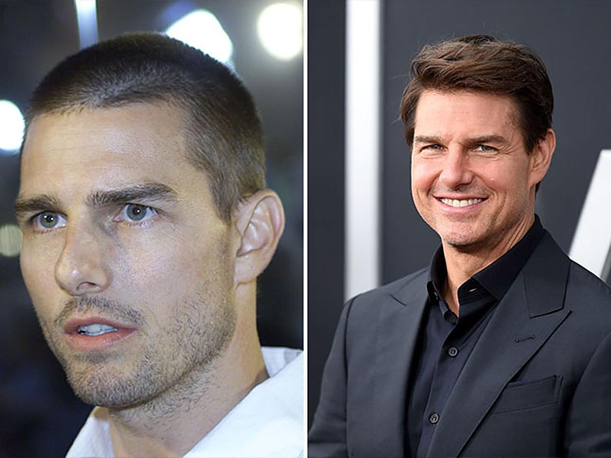 Tom Cruise es uno de lo famosos de Hollywood que más operaciones de estética se ha practicado.