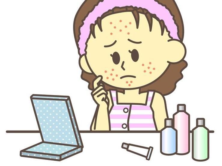 Fotos: Acné: las últimas novedades para acabar con él