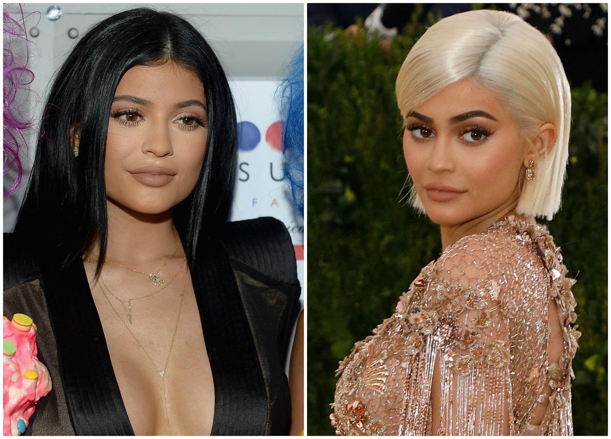 Además de los labios, Kylie también se ha retocado otras zonas del rostro. Poco a poco ha ido modificando sus rasgos. En los últimos años se ha afilado la barbilla, se ha aumentado el busto y el trasero.