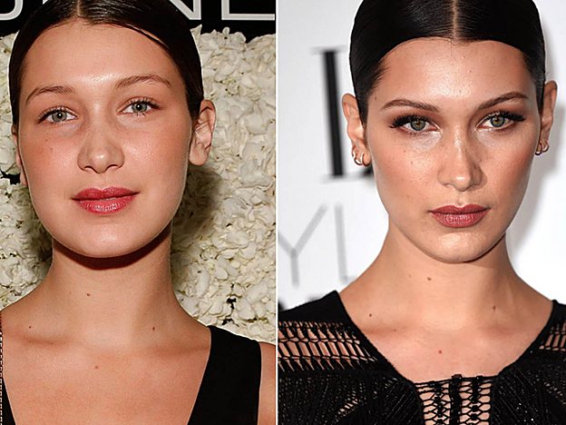 El antes y el después de la bichectomía en Bella Hadid.