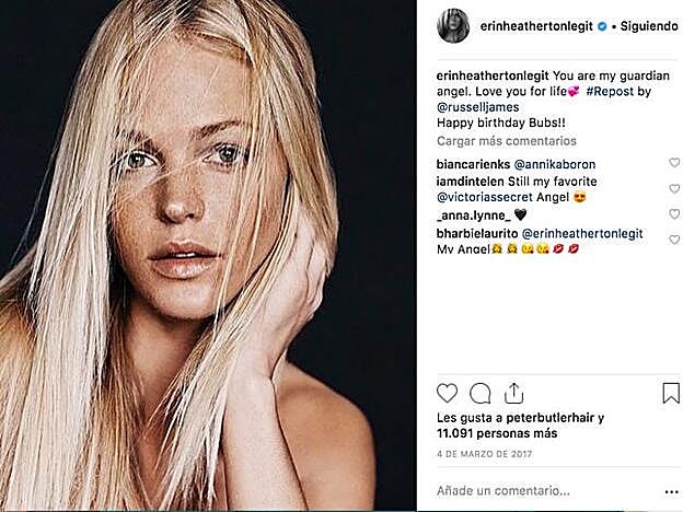 Las pecas son una de las señas de identidad de Erin Heatherton, uno de los ángeles de Victoria’s Secret.