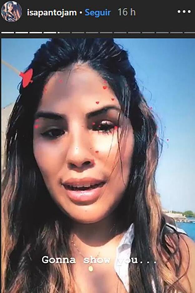 Los inflamados labios de Chabelita Pantoja.